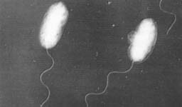 腸炎ビブリオの電子顕微鏡写真