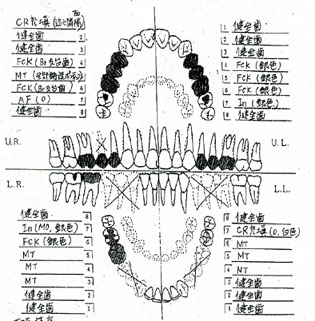 デンタルチャート